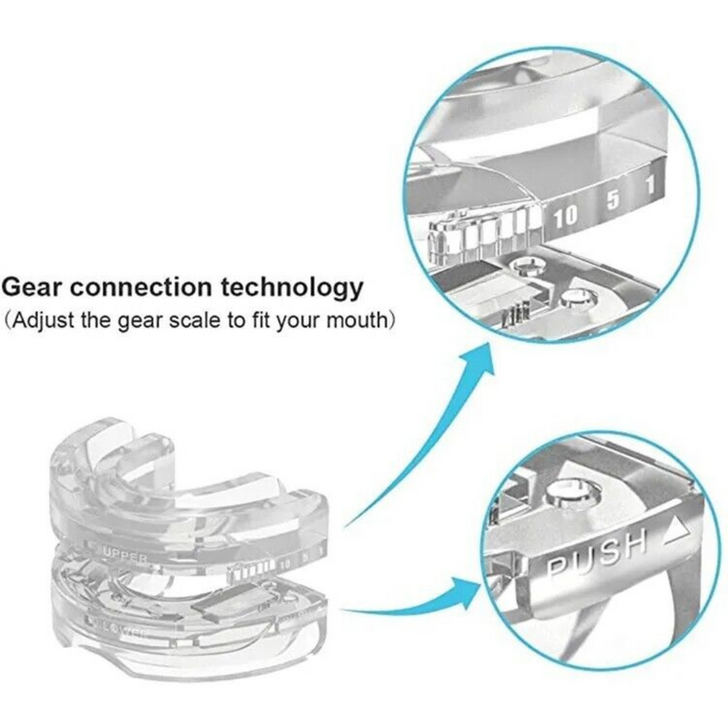 SnoreNoMore™ Mouthpiece